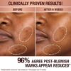 DARK SPOT CORRECTING INVISIBLE UV DUO SKINCARE KIT