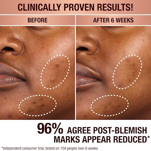 DARK SPOT CORRECTING INVISIBLE UV DUO SKINCARE KIT